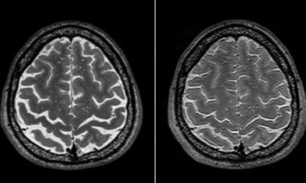 La struttura cerebrale nello spazio