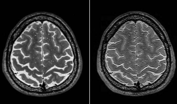 La struttura cerebrale nello spazio