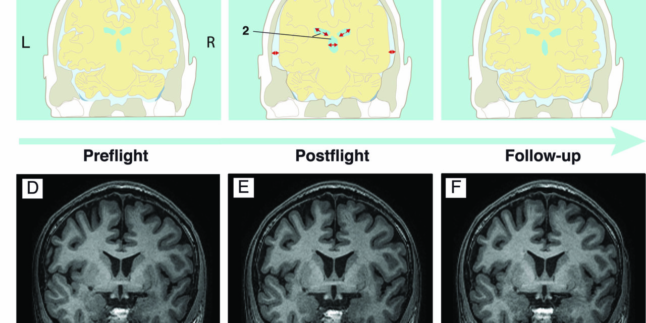Viaggi spaziali, quali effetti sul cervello?