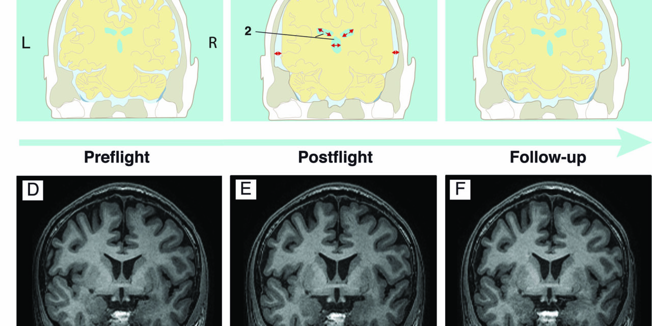 Viaggi spaziali, quali effetti sul cervello?