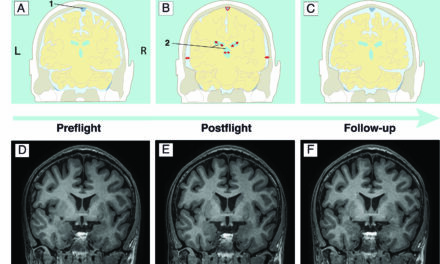 Viaggi spaziali, quali effetti sul cervello?