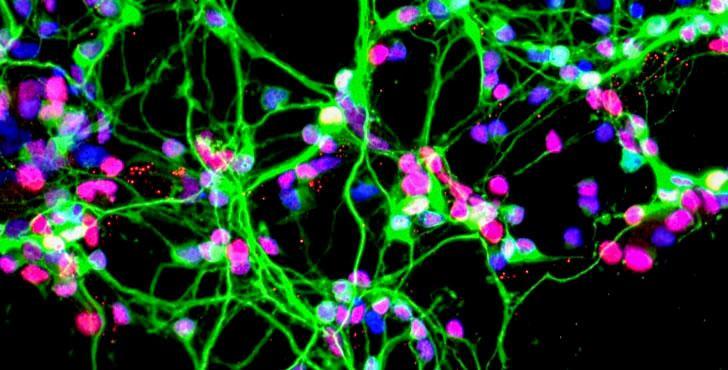 Malattie neurodegenerative, un aiuto dallo spazio