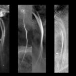 Misteriose strutture pendenti in galassie diverse dalla Via Lattea