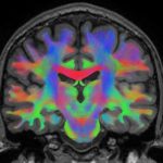 Come il cervello si adatta all’assenza di gravità