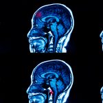 Impatti sul cervello umano durante i voli spaziali
