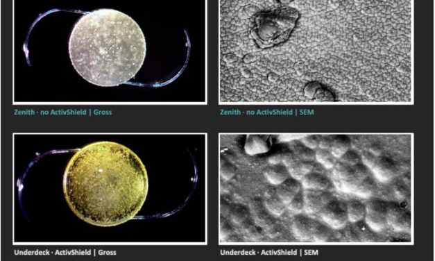 Tutte e sei le Light Adjustable Lens (Lal), una particolare tipologia di lenti intraoculari, hanno mostrato la stessa alterazione della superficie dopo l'esposizione all'ambiente spaziale